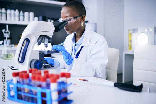 Science, laboratory and woman on microscope for blood test research, medical analysis and dna or virus tube. Biotechnology, healthcare and scientist, doctor or african person check for particles