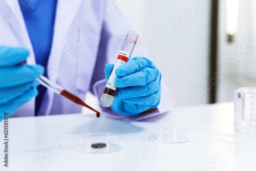 Print op canvas Scientist holding Coronavirus covid-19 infected blood sample tube DNA testing of the blood in the laboratory with blood sample collection tubes and syringe Coronavirus Covid-19 vaccine research