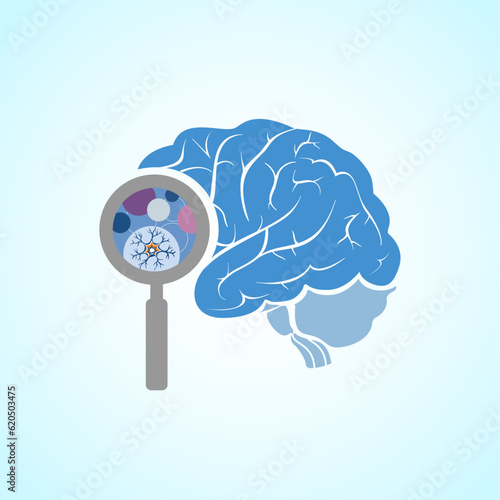 Brain Tumor, Medical Infographic, Neurology Concept Vector Illustration Design