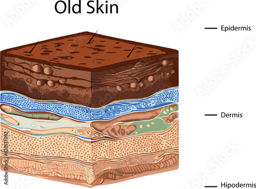 Diagram showing the structure of an old skin on a white background