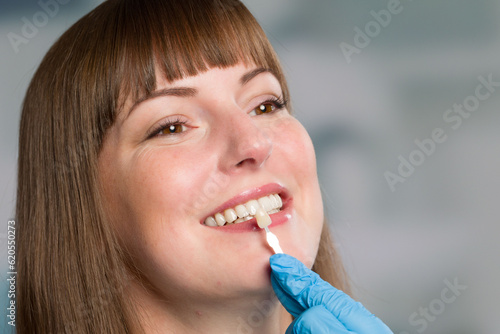 Close-up of dentist using shade guide at woman's mouth to check veneer of teeth for bleaching