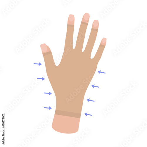 Female hand in Compression Glove. Woman's hand. Arthritis gloves. Swelling, Edema, Lymphedema, Post Surgery. Blood flow. Medical underwear. Specialized hosiery for diseases. Vector illustration.