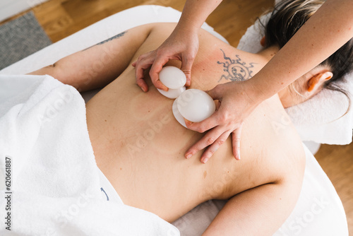 Woman On A Cupping Therapy photo