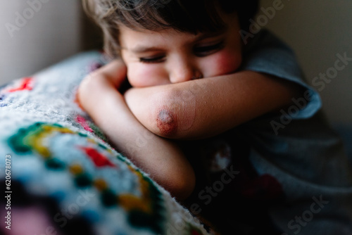 Little boy shows skinned elbow photo