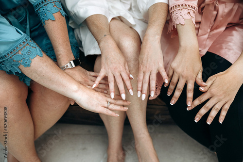 Women show freckles on their arms and legs. Freckles on the body of young women close-up. Three women sit on a couch and show off their freckled skin