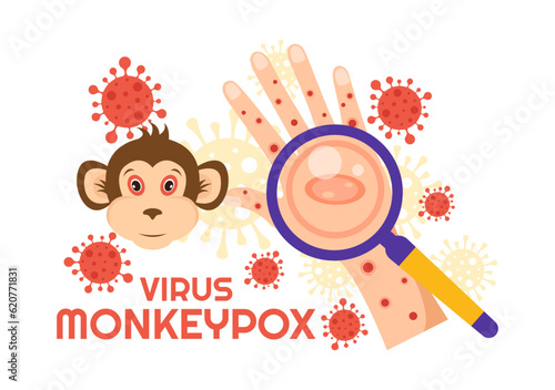 Monkey Pox Outbreak Vector Illustration of Virus Symptoms in Humans Monkeypox Microbiological in Flat Cartoon Hand Drawn Templates