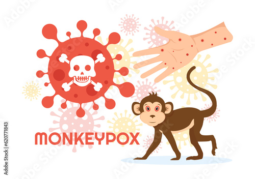 Monkey Pox Outbreak Vector Illustration of Virus Symptoms in Humans Monkeypox Microbiological in Flat Cartoon Hand Drawn Templates