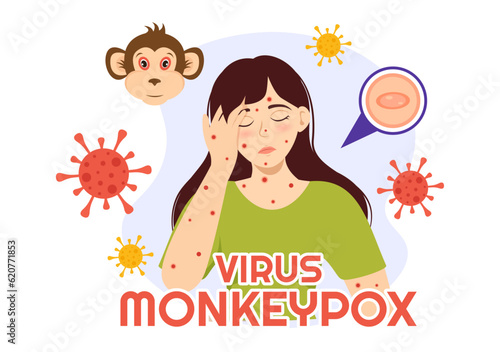 Monkey Pox Outbreak Vector Illustration of Virus Symptoms in Humans Monkeypox Microbiological in Flat Cartoon Hand Drawn Templates
