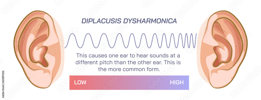 Difference between two ears, double hearing, density or pressure of sound, different frequency, compression, rarefaction and ambient pressure. travelling sound wave, Dysharmonica and echoica. sound Difference between two ears, double hearing, density or pressure of sound, different frequency, compression, rarefaction and ambient pressure. travelling sound wave, Dysharmonica and echoica. sound