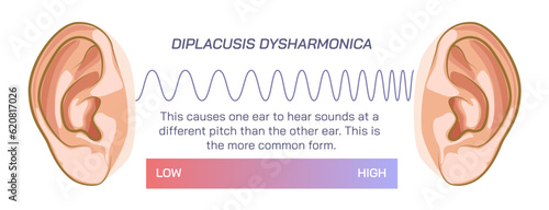 Difference between two ears, double hearing, density or pressure of sound, different frequency, compression, rarefaction and ambient pressure. travelling sound wave, Dysharmonica and echoica. sound