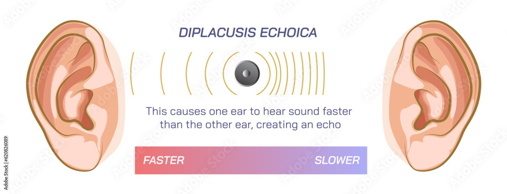 Difference between two ears, double hearing, density or pressure of sound, different frequency, compression, rarefaction and ambient pressure. travelling sound wave, Dysharmonica and echoica. sound Difference between two ears, double hearing, density or pressure of sound, different frequency, compression, rarefaction and ambient pressure. travelling sound wave, Dysharmonica and echoica. sound
