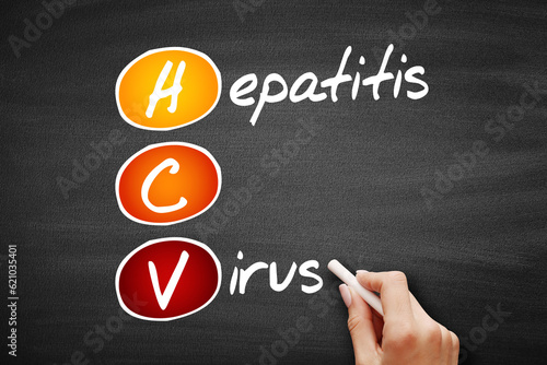 HCV - Hepatitis C virus, acronym health concept on blackboard photo