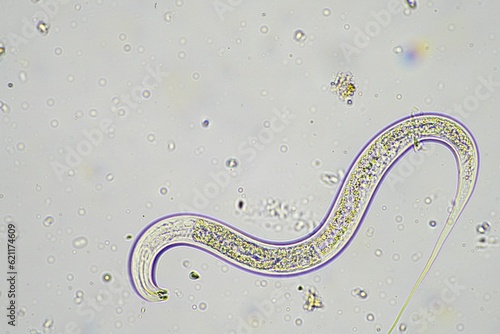soil switcher nematode, microorganism and soil biology, with nematodes and fungi under the microscope. in a soil and compost sample photo