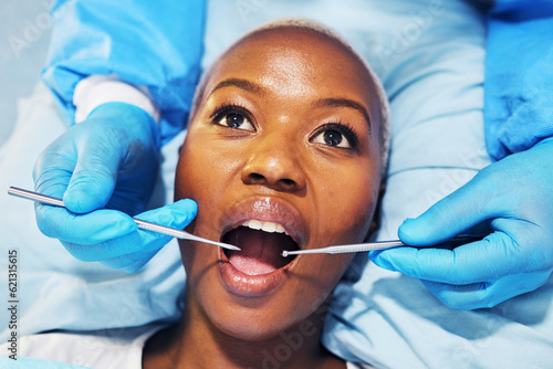 Dental surgeon  woman and tools in mouth at clinic for cavity  teeth whitening and helping hand for pain. Dentist  African patient and top view for tooth extraction  care and check for healthy smile