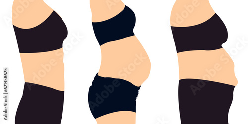 Womans Belly Tummy Tuck flabby skin Female Body Abdomen. Alcohol Hormonal Stressed Mommy Apron Sagging protruding superficial tummy Demonstrating Liposuction. Diet Weight Loss Fat Belly slim stomach
