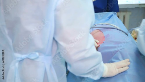 Surgeons team hands during laparoscopic abdominal operation. Operation using endoscopic equipment. 