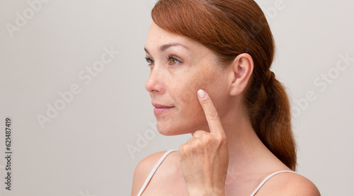 Portrait of cropped caucasian middle aged woman face with freckles showing on skin by index finger on white background