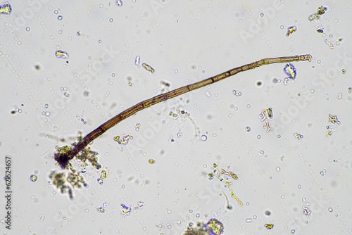 fungal hyphae under the microscope photo