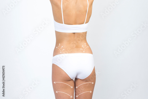 Cellulite removal scheme on body girl. White arrows markings on the waist and legs young woman.