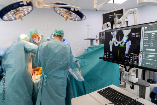 Team of doctor perform total hip arthroplasty replacement surgery in osteoarthritis patient inside the operating room. robot-assisted - robotic hip and knee replacement surgery