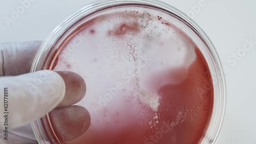 Bacteria culture growth on a petri dish in microbiology lab. Candida auris. Microbial cultures growth on selective media plate in microbiology laboratory. Biomarker. Bio-reagent. Fungus and mold.