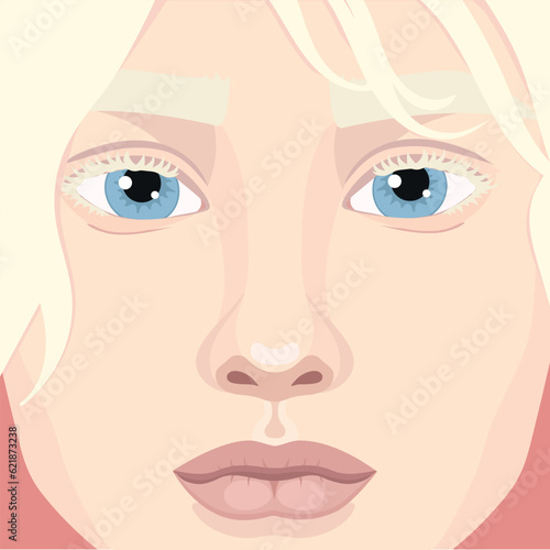 Beautiful albino girl face close up. Woman with blondie hair and albinism. Genetic rare appearance. Vector illustration