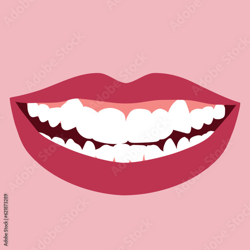 Smile with orthodontic problem teeth crowding. Double tooth. Abnormal eruption. Opposite occlusion, open bite, crowded teeth, cavities, dentition. Vector illustration