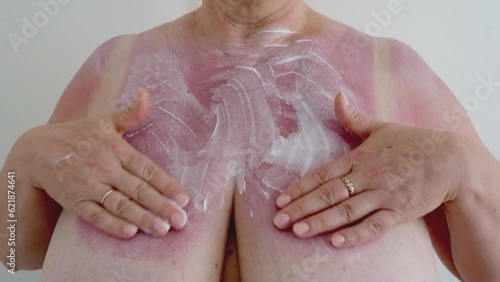 Middle-aged woman applying after-sun cream