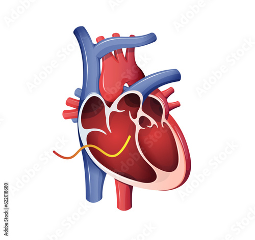 Human Heart Cross Section - Stock Illustration