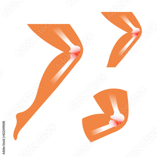 Knee joint pain illustration. Bones ache vector isolated on white.