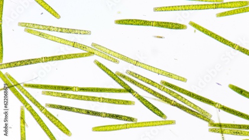 Algae blooming under microscope. The species are Pleurotaenium sp and Closterium sp. Live cell. 220x magnification. Selective focus image photo