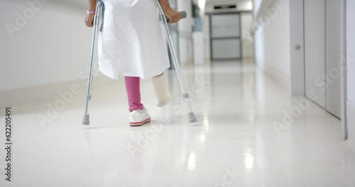 Lowsection of african american girl in hospital gown walking using crutches in corridor, slow motion photo