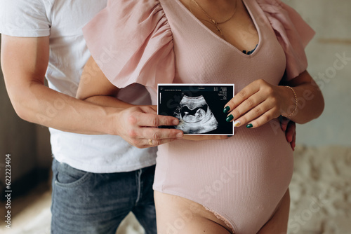 woman holding ultrasound scan