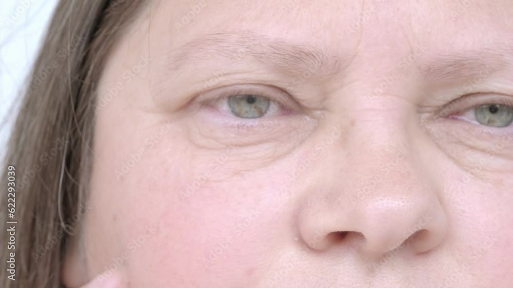 mild swelling or puffiness under eyes, upper part of woman's face, an elderly woman close-up, small and large mimic wrinkles, concept poor vision, eye fatigue, correction of elasticity of aging skin mild swelling or puffiness under eyes, upper part of woman's face, an elderly woman close-up, small and large mimic wrinkles, concept poor vision, eye fatigue, correction of elasticity of aging skin