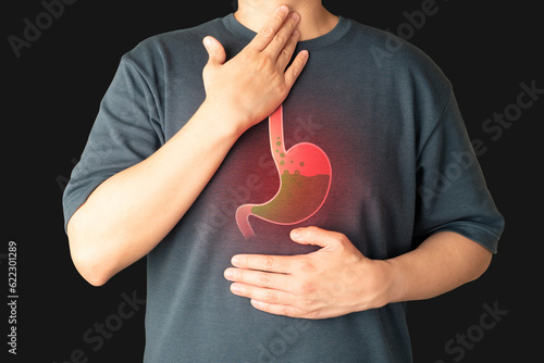 Photographie Gastroesophageal reflux disease (GERD) or acid reflux symptoms