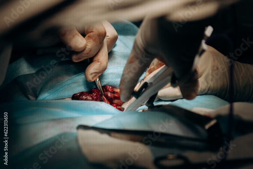 surgeon working in operating room