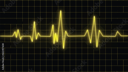 Yellow heartbeat diagram on red graph paper. Electrocardiogram chart. Heart attack. Ischemic. Coronary artery disease. Angina pectoris. Chest pain. ECG. EKG. Medical health care.