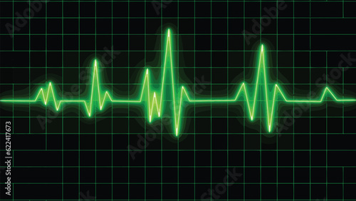 Electrocardiogram show (STEMI) pattern. Heart attack. Ischemic. Coronary artery disease. Angina pectoris. Chest pain. ECG. EKG. Medical health care.