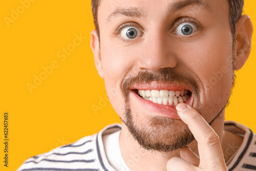 Young bearded man showing h...