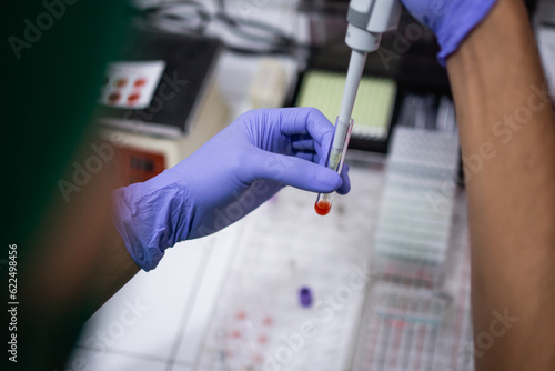 Vászonkép Doctor's hand using an eyedropper puts a blood sample into a small tube in the l