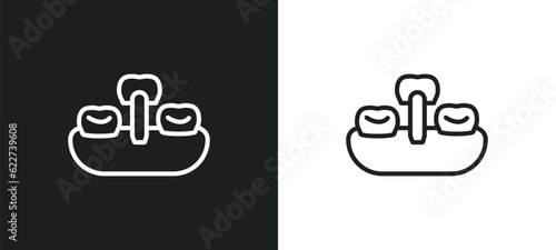 overdenture outline icon in white and black colors. overdenture flat vector icon from dentist collection for web, mobile apps and ui.