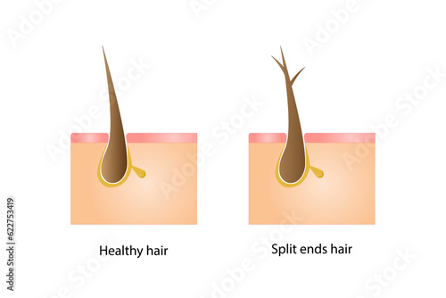 Healthy hair and split ends hair on white background. Hair care. Hair problems. Vector illustration.