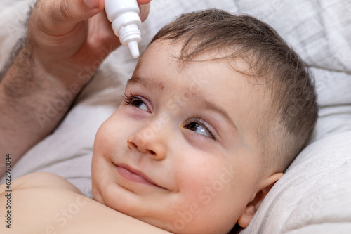 cute infant baby boy with purulent acute bacterial conjunctivitis lying on bed. puffy red eye, virus infection.mother giving eye drops to kid child photo