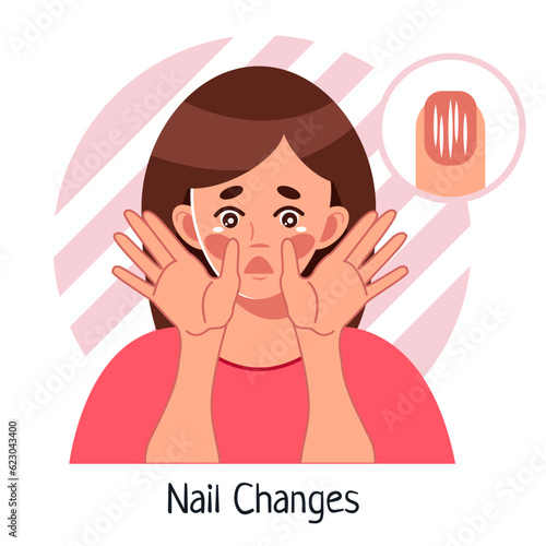 Nail Changes. A frightened woman looks at her nails. Brittle nails, nail pits, depressions. A symptom of anemia, lack of vitamins. Vector medical illustration in cartoon styled