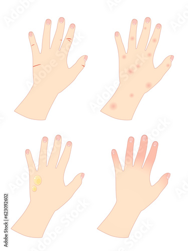 Rough hands woman2