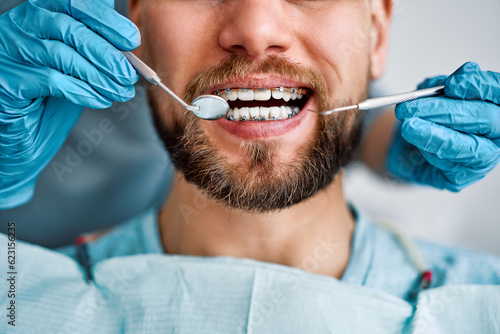Cropped portrait of handsome man with braces sitting in dental chair. Doctor in gloves holding examination tools behind. Braces, alignment of teeth.