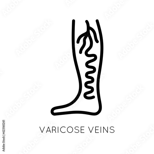 Varicose veins icon. Swelling of the vein, improper blood circulation. Incorrect operation of the valves.