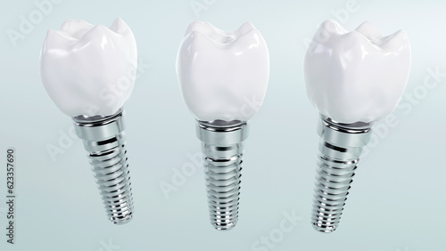 Fototapeta Naklejka Na Ścianę i Meble -  3d rendering of tooth implants with ceramic crowns on color background, Modern dental surgery concept
