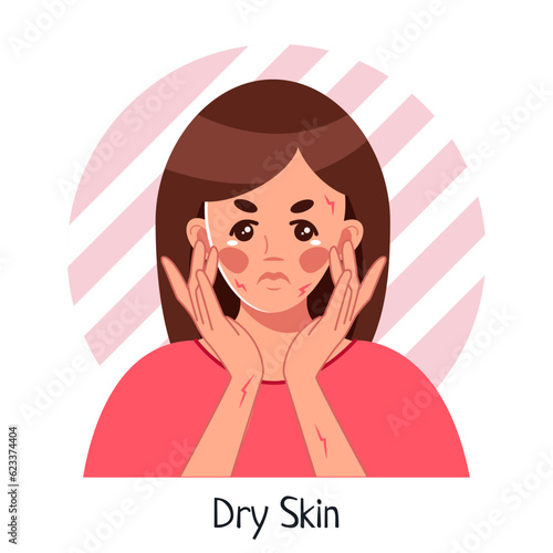 Dry skin. A young upset woman with problematic skin. A symptom of allergies, psoriasis. Itching, atopic dermatitis, eczema, dryness, redness. Vector medical illustration in cartoon style