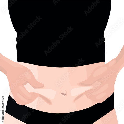 Women touch fat on the belly with excessive weight. loose and excess skin on the abdomen. Fat female in black underwear 